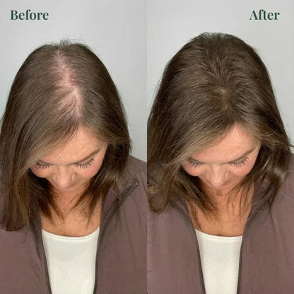 Kerarose Rosemary + Keratin Shampoo (100ml)